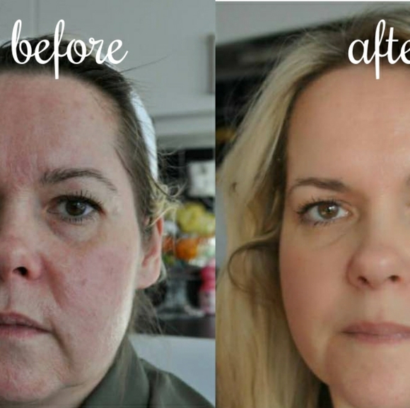 PREORDER ONLY Anti-Wrinkle/Crow's Feet/Sagging Skin - Picture 1 of 4